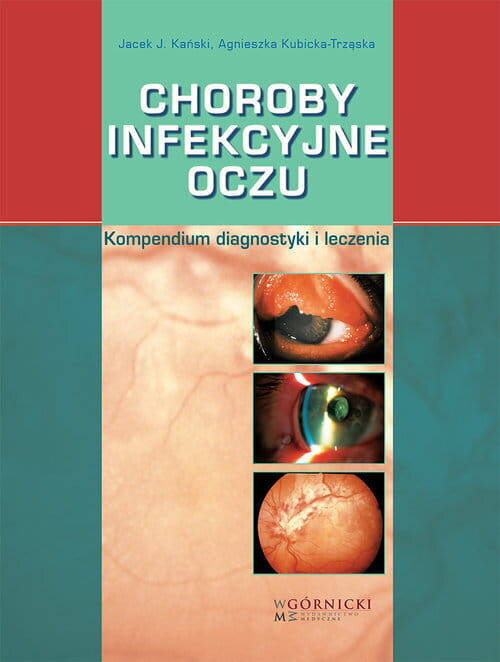 Choroby infekcyjne oczu. Kompendium diagnostyki i leczenia